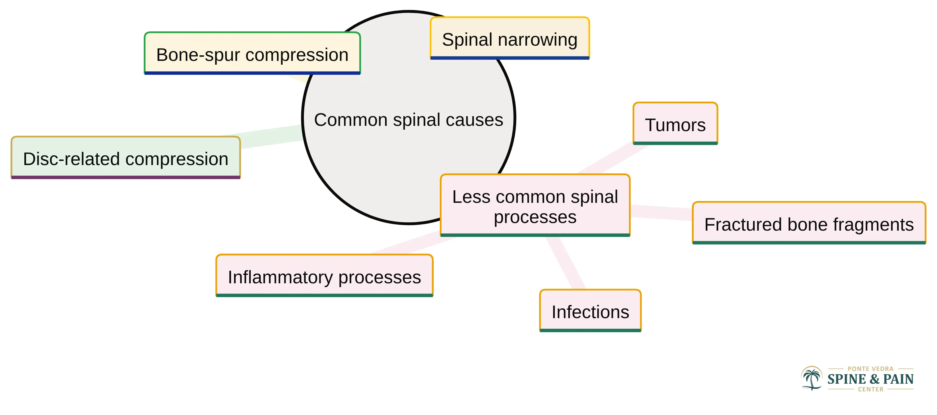 Concept chart showing common spinal causes of sciatica-like nerve-root pressure: disc-related compression, bone-spur compression, spinal narrowing, and less common spinal processes including fractured bone fragments, tumors, infections, and inflammatory processes.